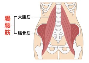 腰痛に関係の深い大腰筋と腸骨筋
